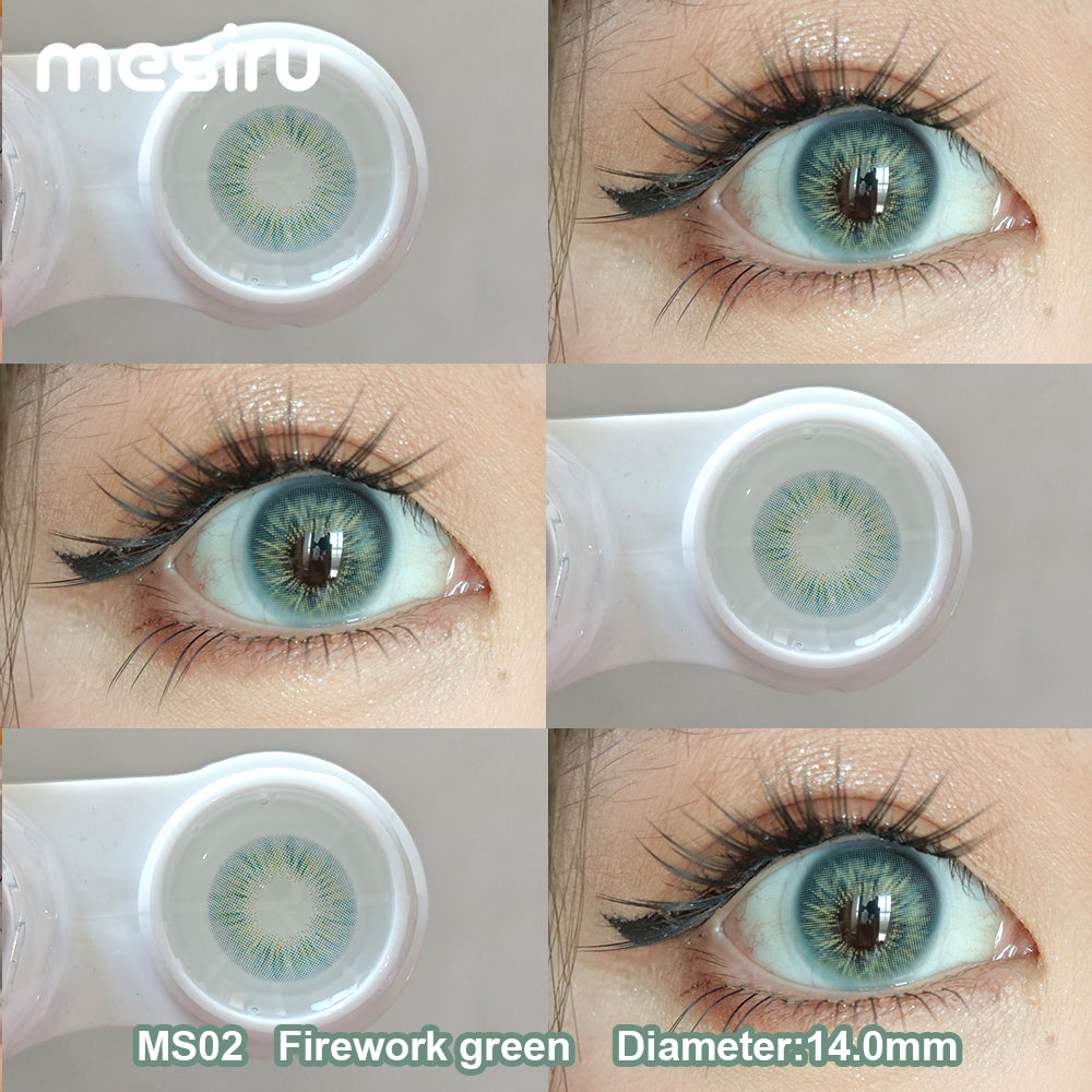 Mesiru MS02 Firework Green